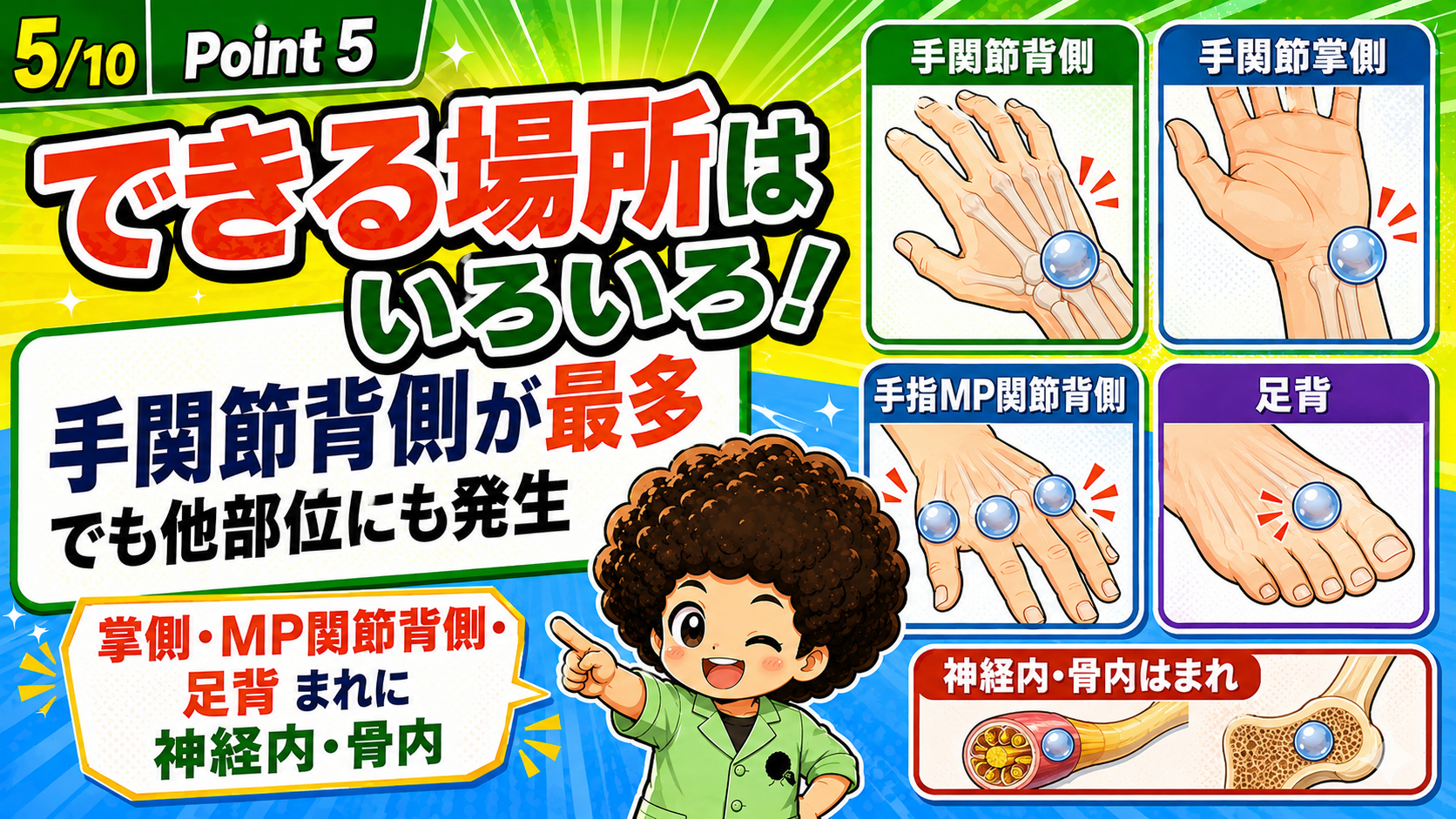 手関節背側が最多だが、掌側・手指MP関節背側・足背にも発生し、まれに神経内・骨内にも生じる