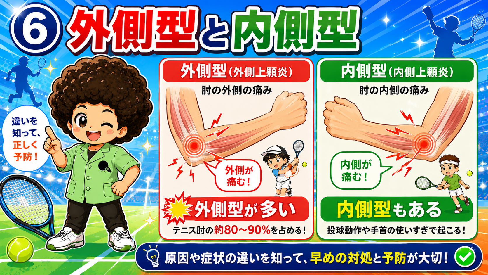 外側型（外側上顆炎）と内側型（内側上顆炎）の違い