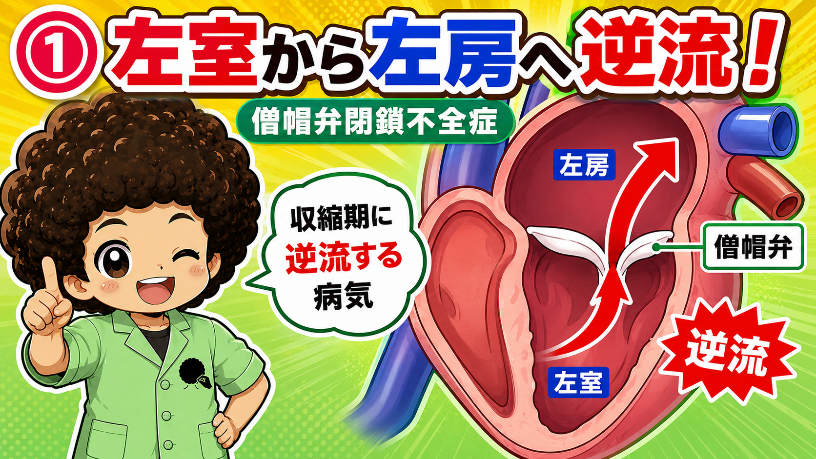 僧帽弁閉鎖不全症｜僧帽弁閉鎖不全症 1