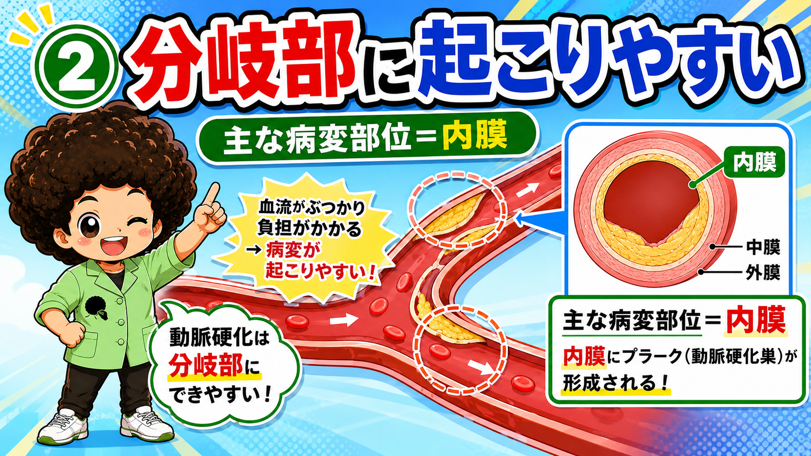動脈硬化は分岐部に起こりやすく、主な病変部位は内膜