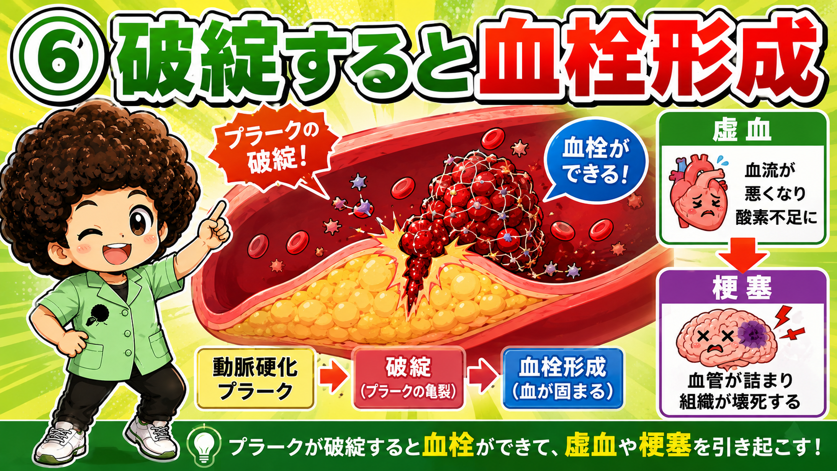プラークが破綻すると血栓ができ、虚血や梗塞を引き起こす