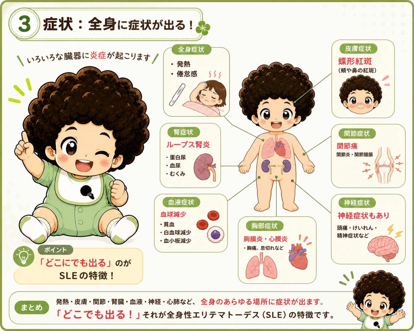 蝶形紅斑・ループス腎炎・関節痛など全身に多彩な症状が出る