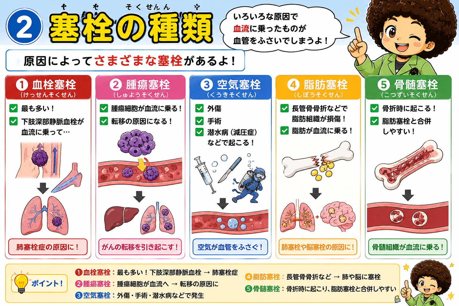 塞栓の5種類 — 血栓・腫瘍・空気・脂肪・骨髄