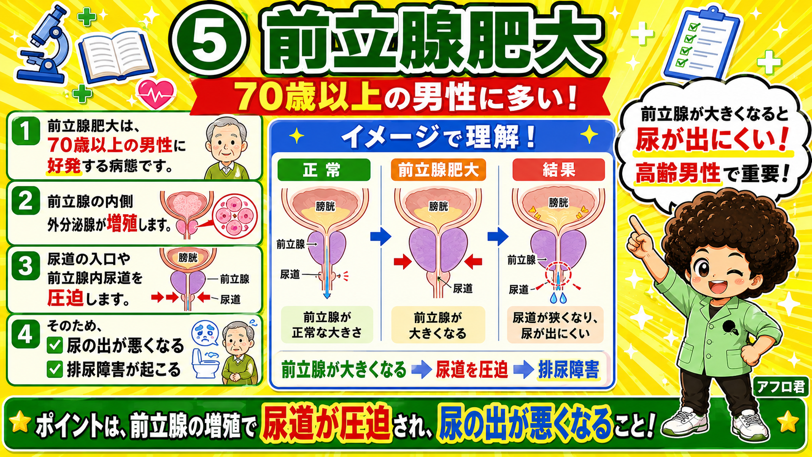 乳腺症の3所見：嚢胞状拡張・線維増生・アポクリン化生