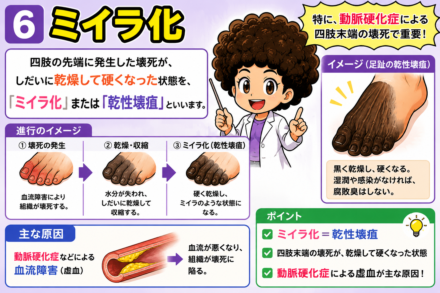 ミイラ化＝乾性壊疽。四肢末端の壊死が乾燥して硬くなった状態、主因は動脈硬化症による虚血