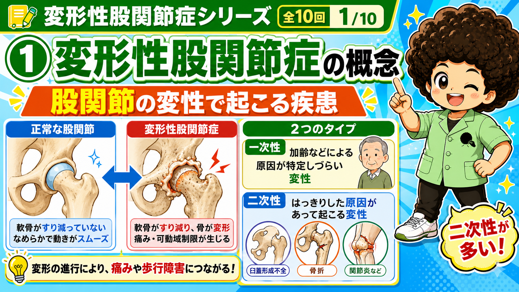 変形性股関節症のリハビリテーション｜変形性股関節症のリハビリテーション 1