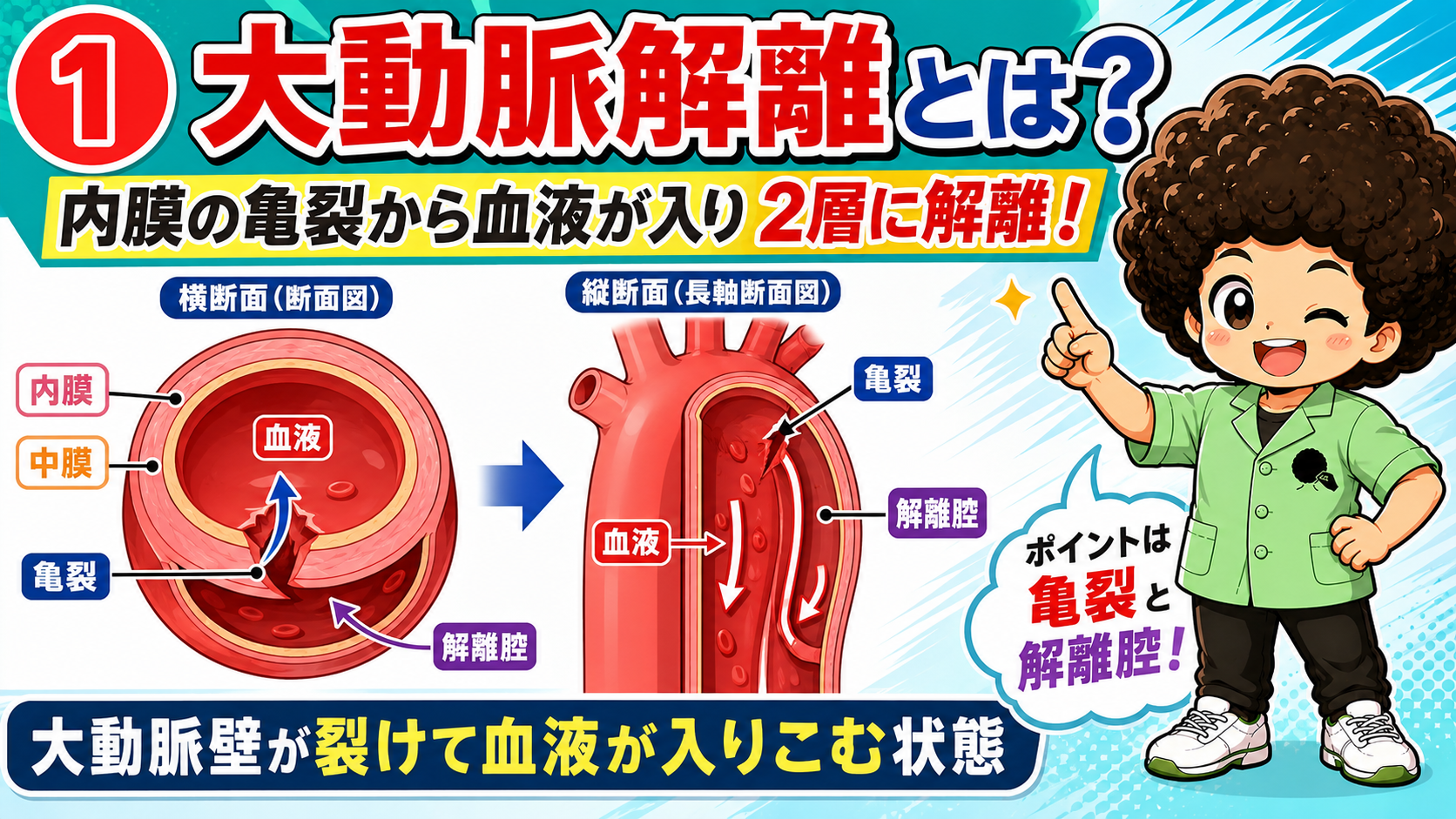大動脈解離｜大動脈解離 1