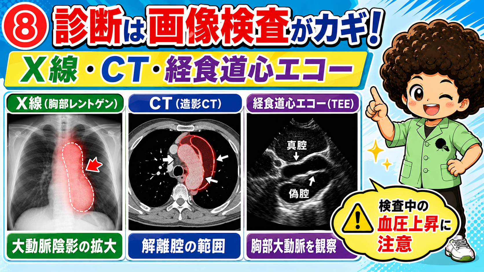 X線・CT・経食道心エコーによる大動脈解離の診断