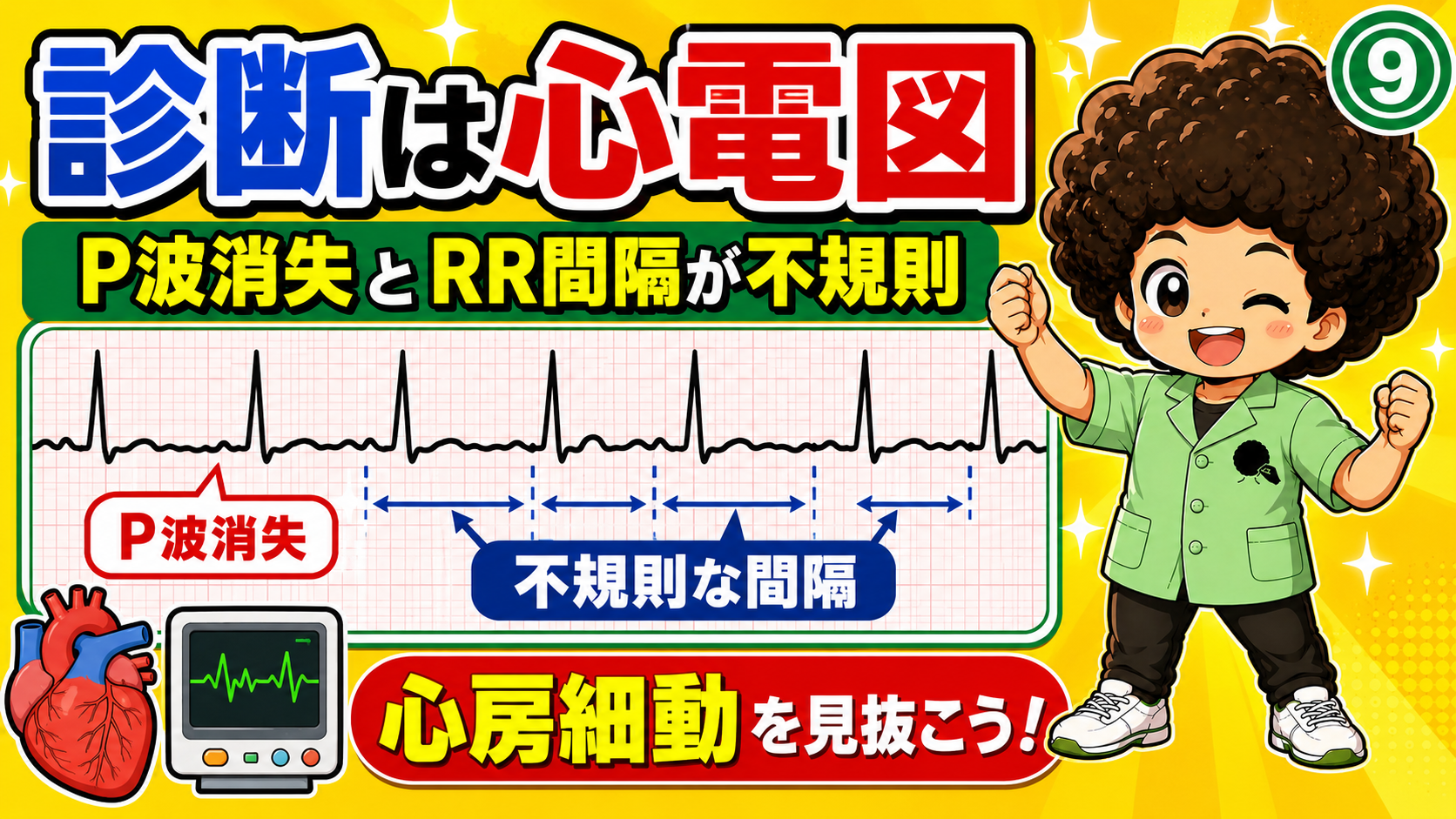 ⑨診断は心電図―P波消失とRR間隔が不規則