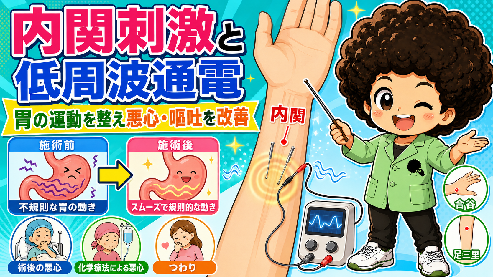 内関刺激と低周波通電。術後の悪心・化学療法による悪心・つわりに