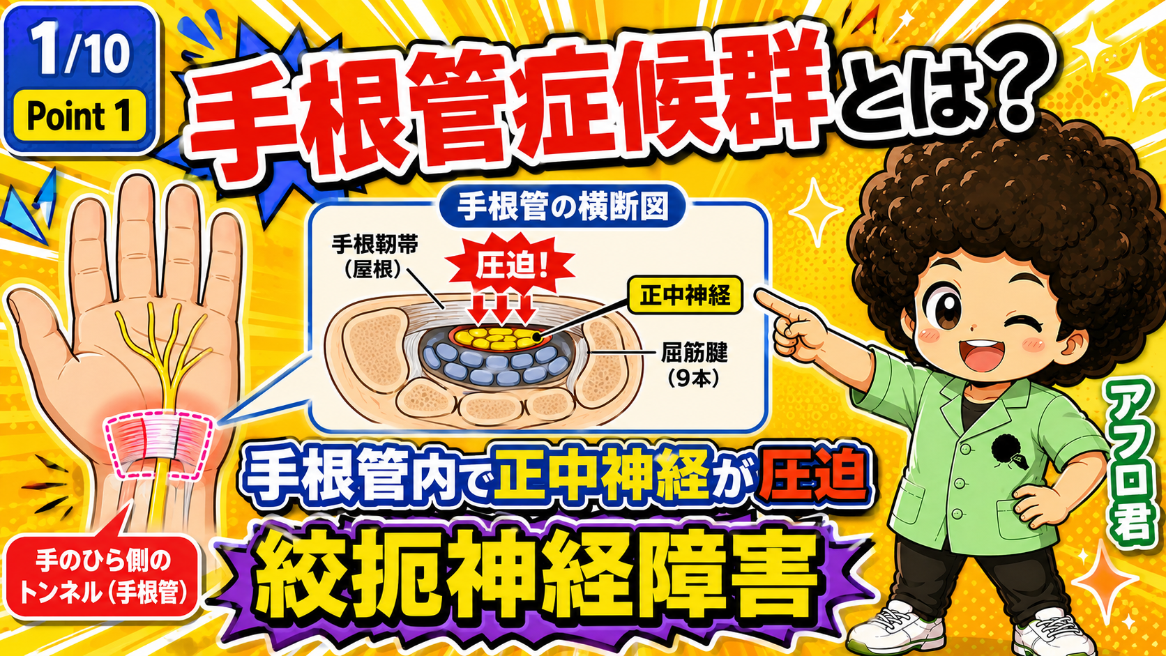手根管症候群｜手根管症候群 1