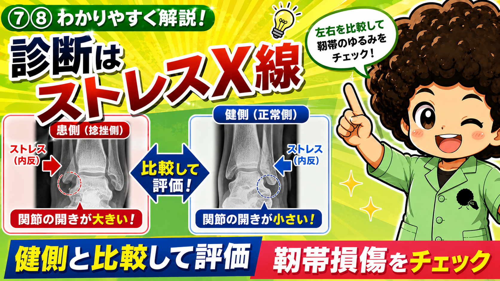ストレスX線。患側は関節の開きが大きく、健側は小さい。左右を比較して靭帯のゆるみを評価する。