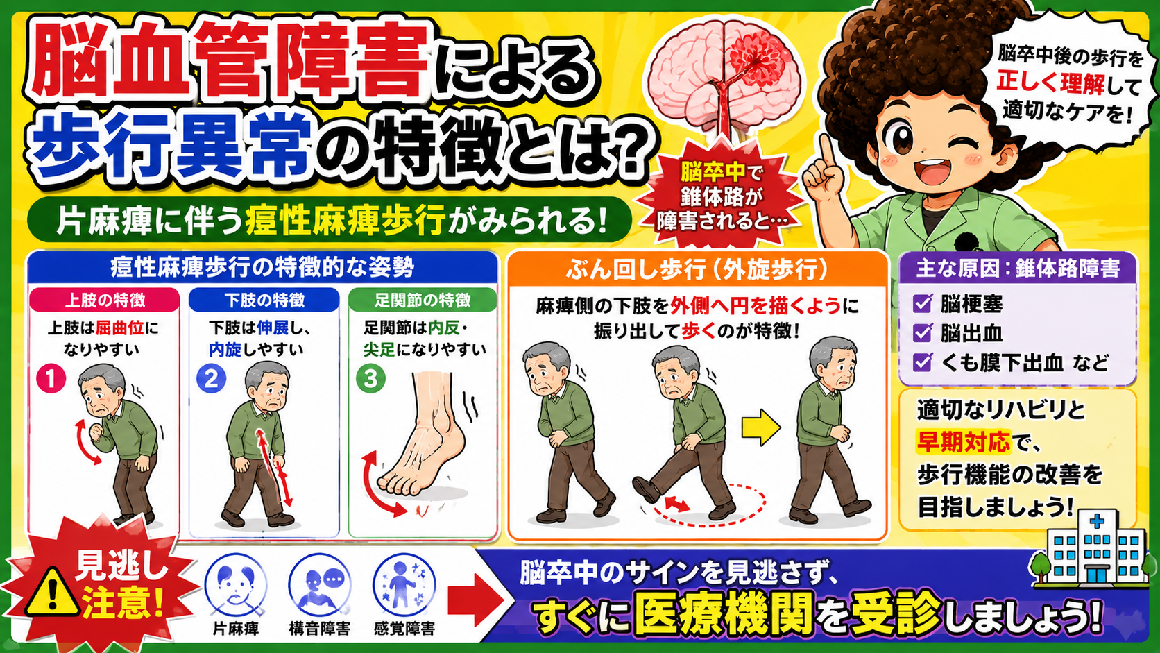 痙性麻痺歩行の姿勢とぶん回し歩行（外旋歩行）