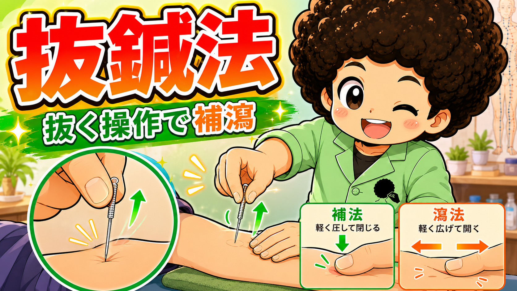 抜鍼法：補法は圧して閉じる、瀉法は広げて開く