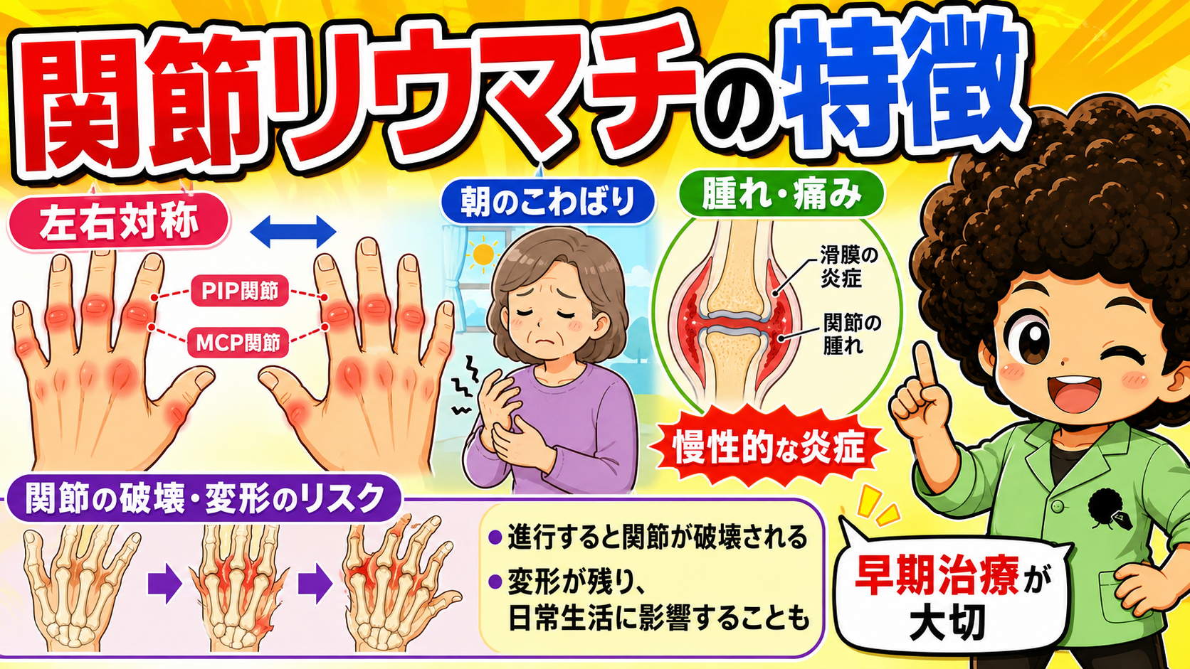 関節リウマチの特徴。左右対称・PIP／MCP関節・朝のこわばり・滑膜の炎症