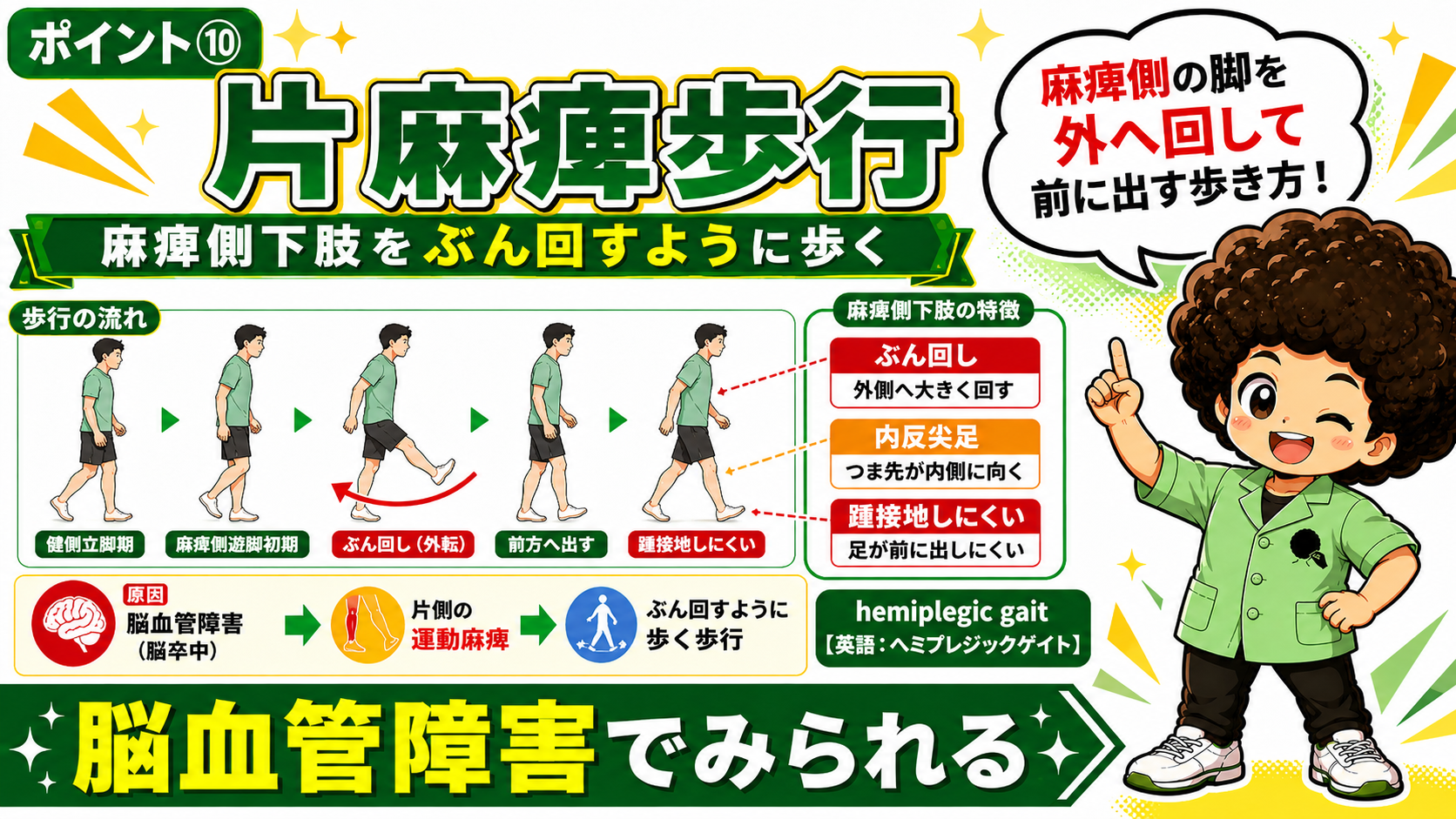 片麻痺歩行：麻痺側下肢を外側へぶん回して前に出す