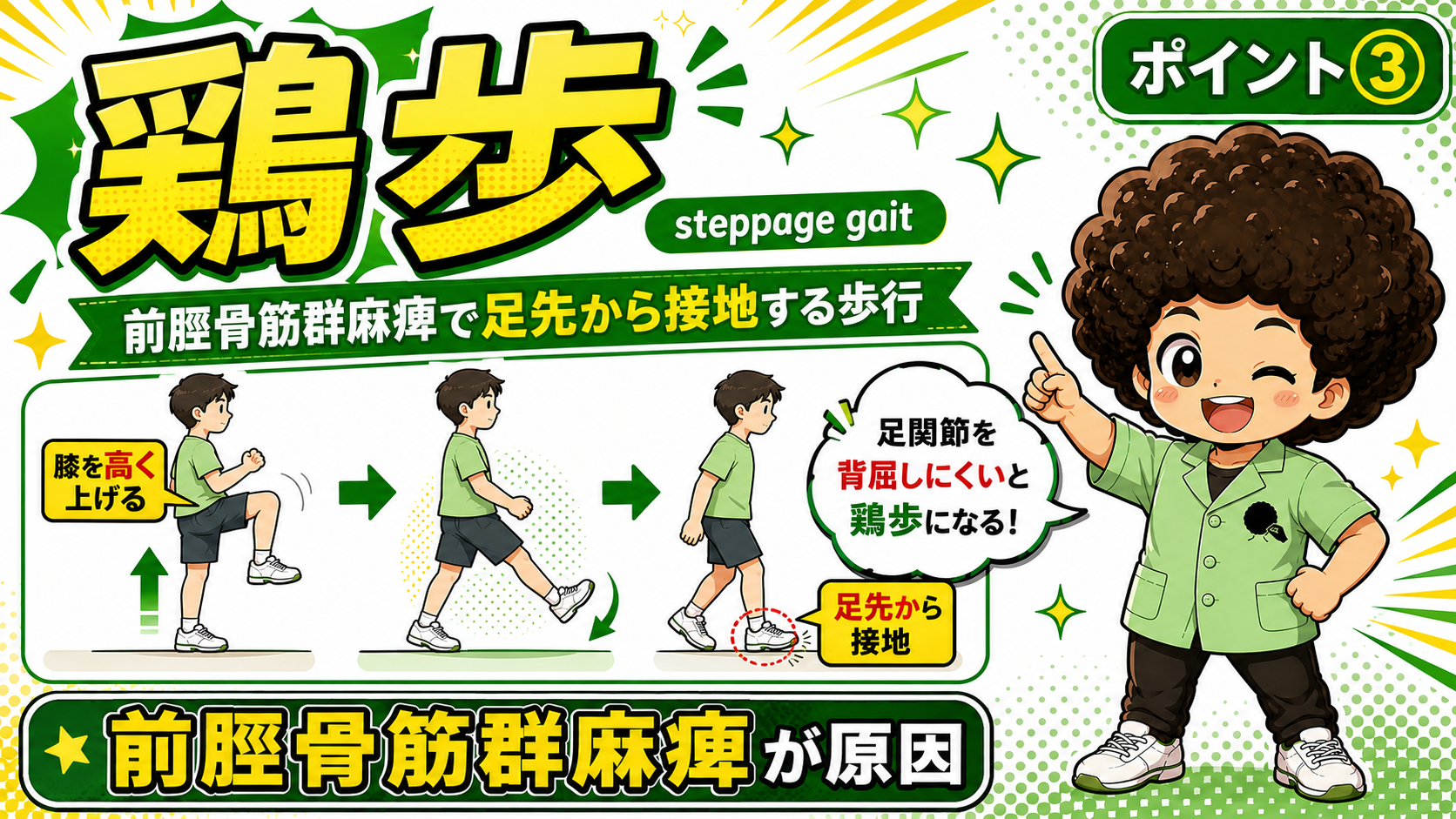鶏歩：前脛骨筋群麻痺で膝を高く上げ足先から接地する