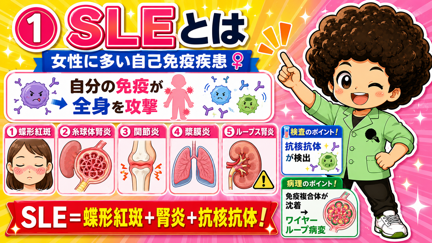 SLE＝蝶形紅斑＋腎炎＋抗核抗体。免疫複合体沈着でワイヤーループ病変