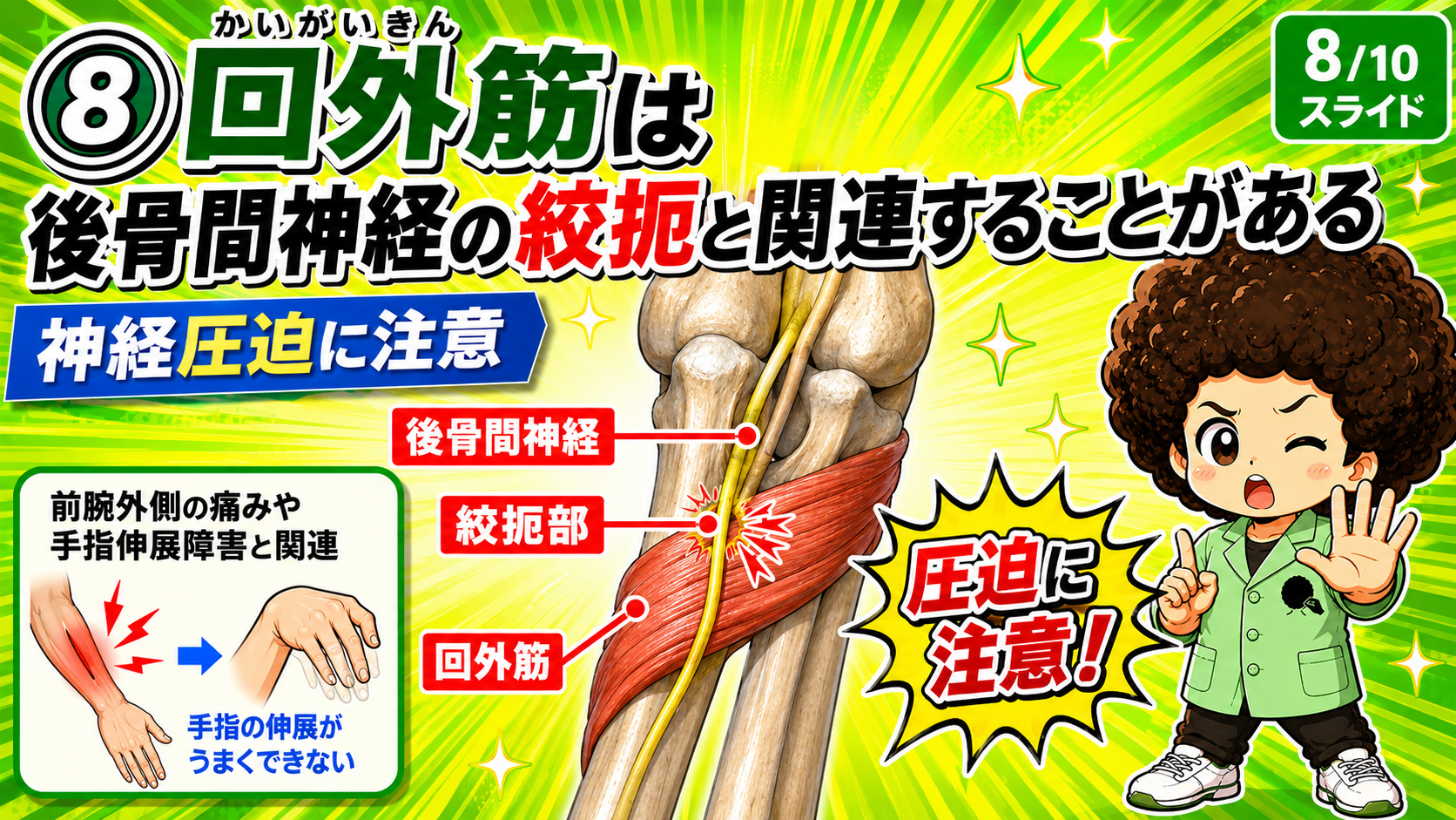 回外筋部で後骨間神経が絞扼される図