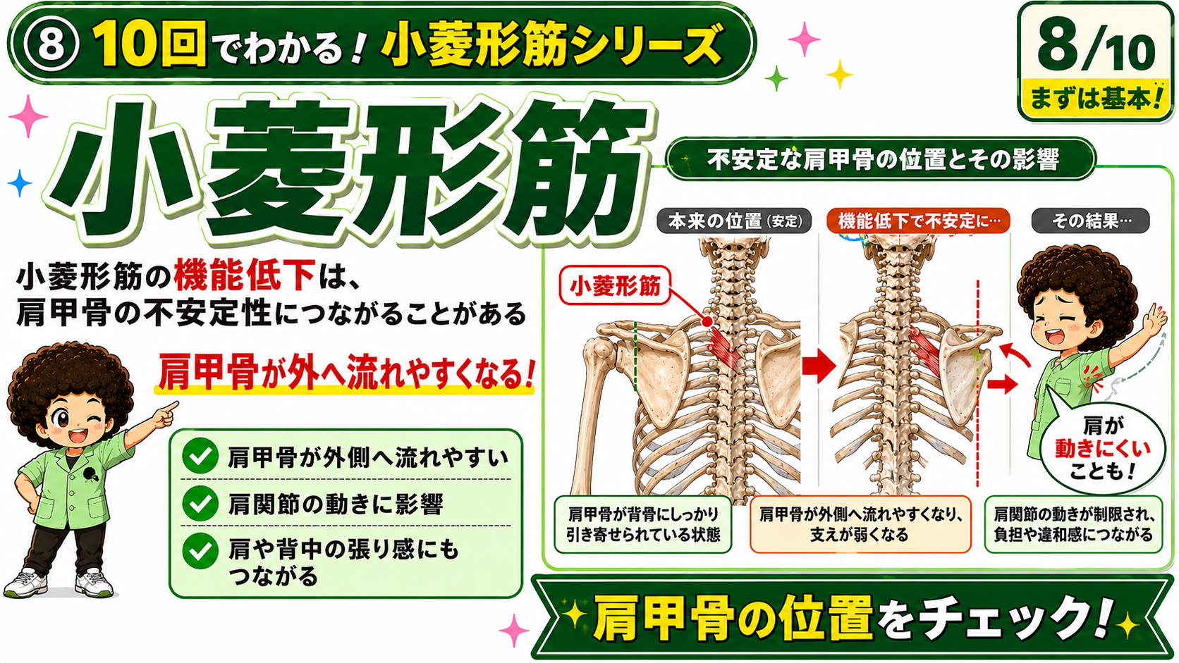 小菱形筋の機能低下で肩甲骨が外側へ流れ、肩の動きに影響する様子を示した図