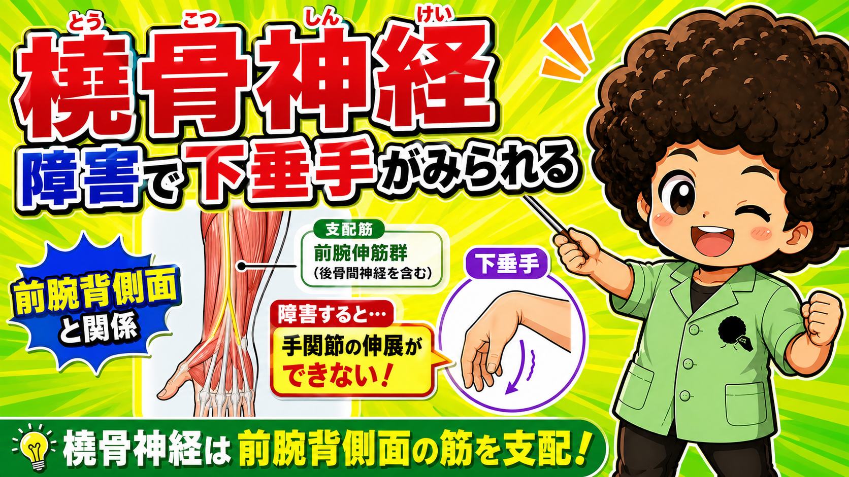 橈骨神経障害でみられる下垂手のイラスト