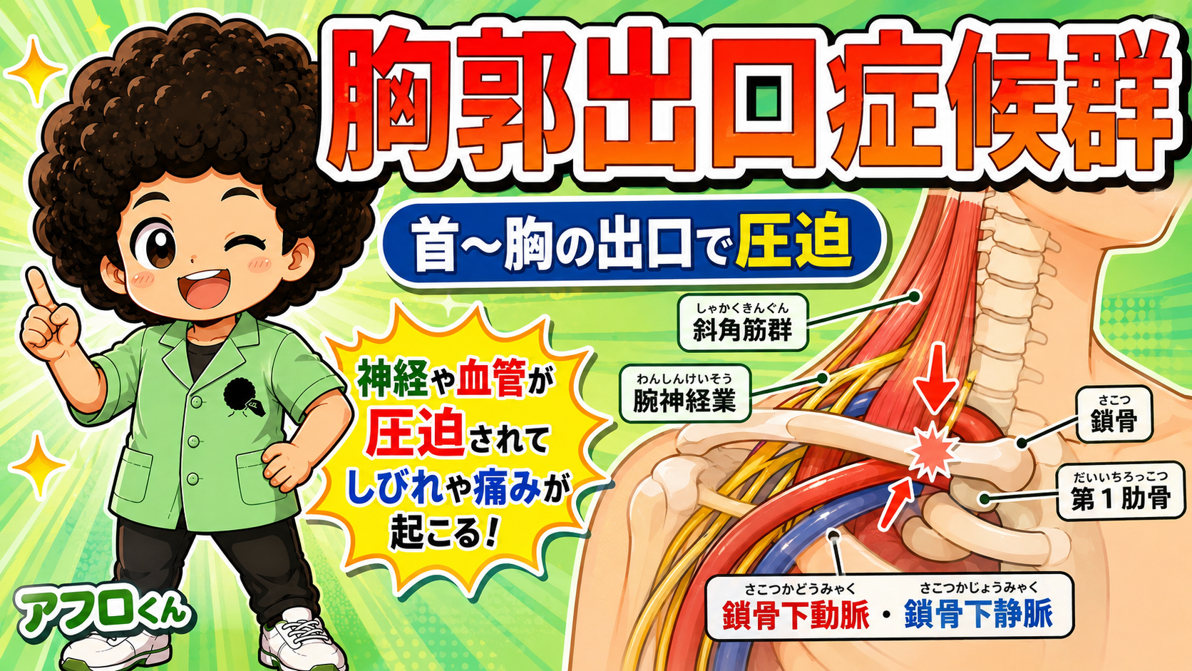 胸郭出口症候群｜胸郭出口症候群 1