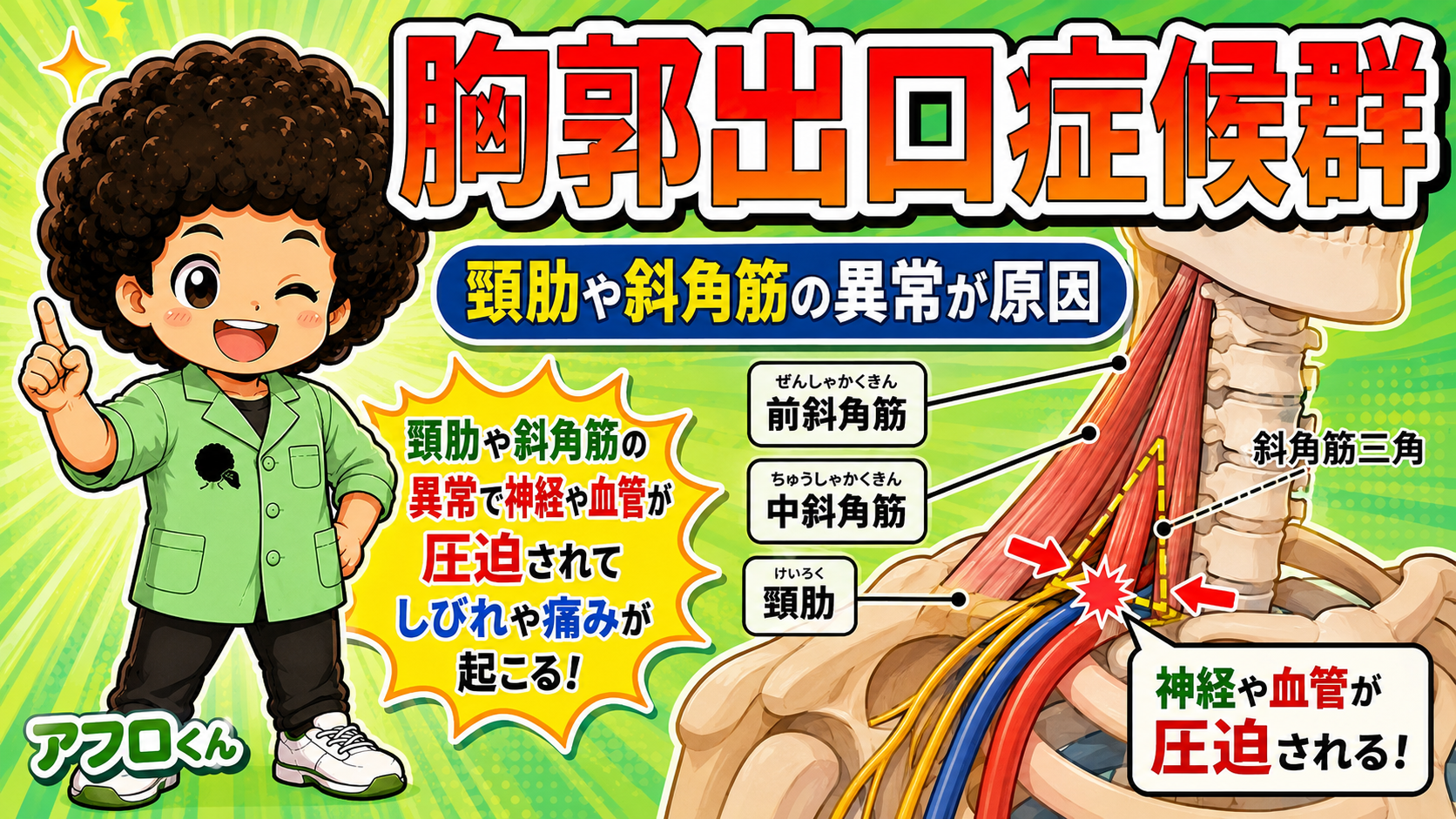 前斜角筋・中斜角筋・第1肋骨で囲まれた斜角筋三角。頸肋があるとここでの圧迫が強まる