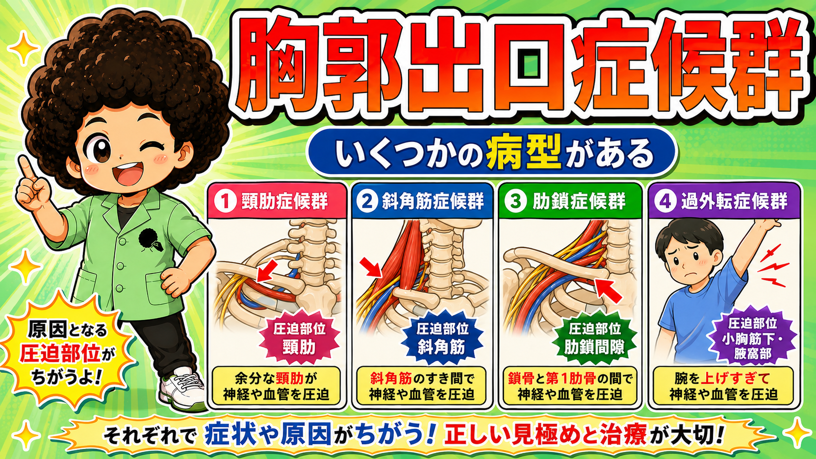 胸郭出口症候群の4病型と、それぞれの圧迫部位