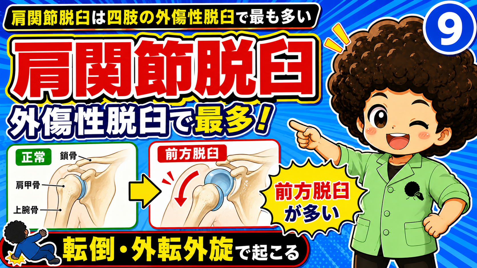 肩関節脱臼は外傷性脱臼で最多。前方脱臼が多く、転倒・外転外旋で起こる。