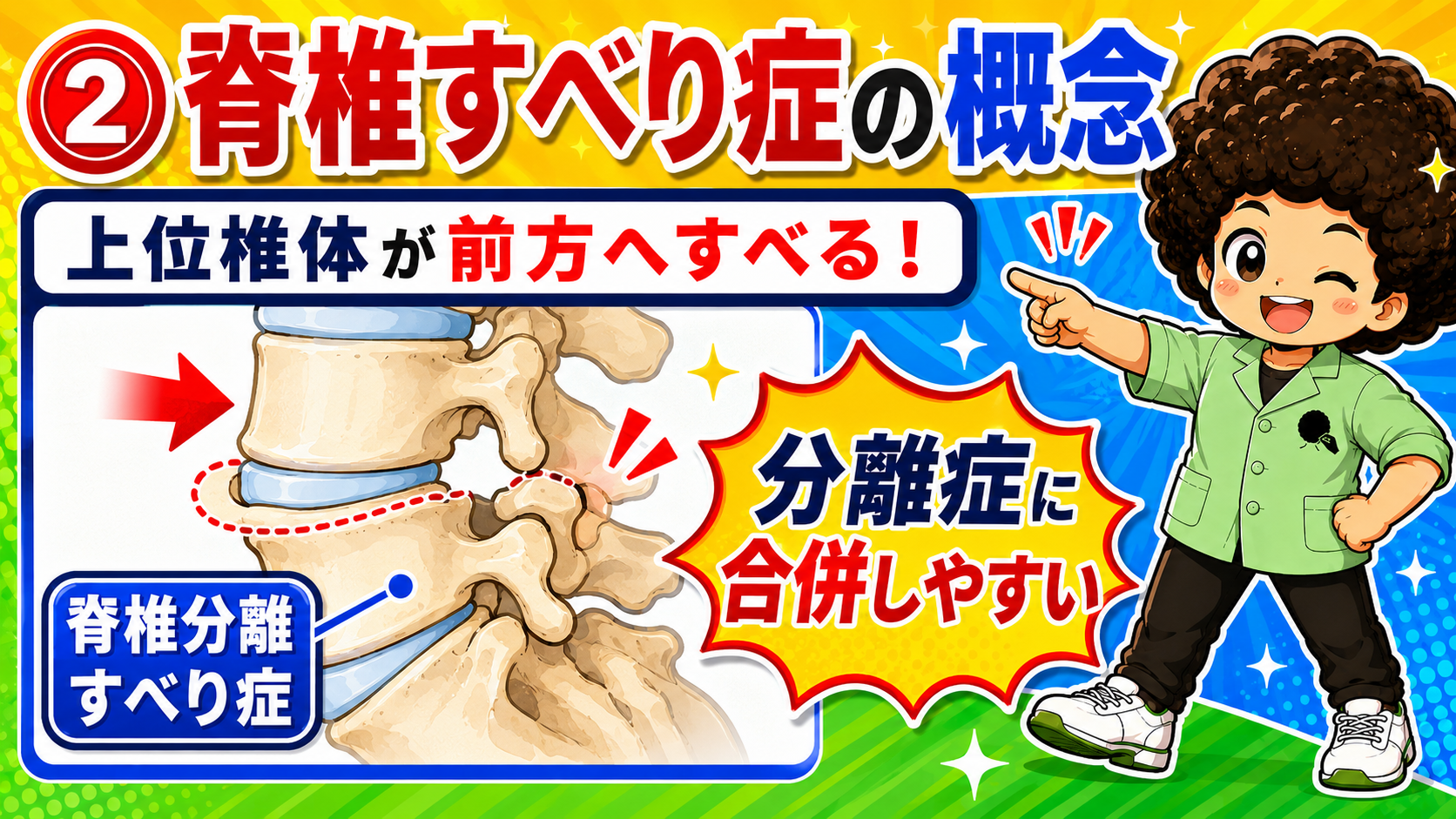 上位椎体が前方へすべる（分離症に合併しやすい）