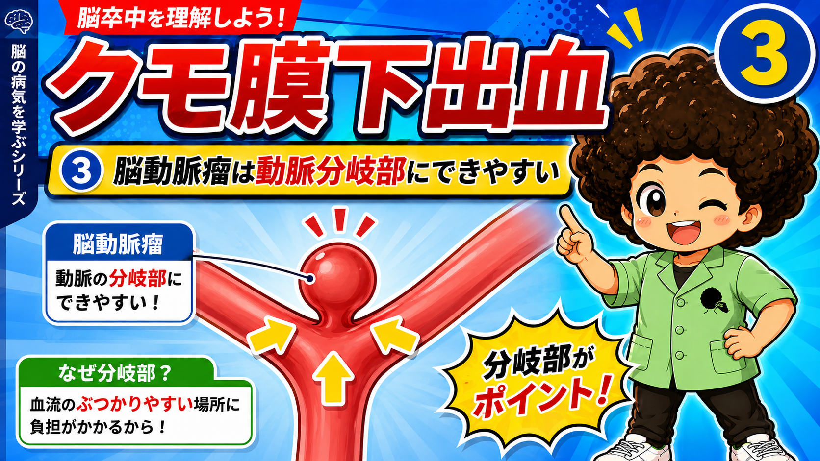 脳動脈瘤は血流がぶつかりやすい動脈の分岐部にできやすい。
