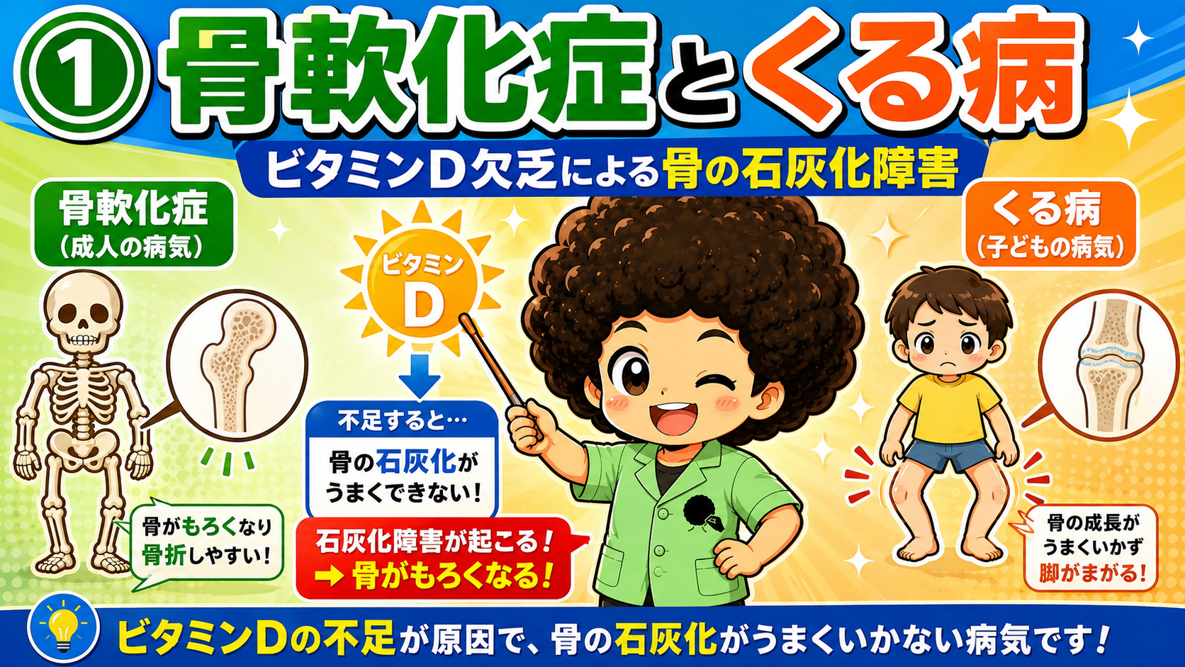 骨軟化症とくる病｜骨軟化症とくる病 1