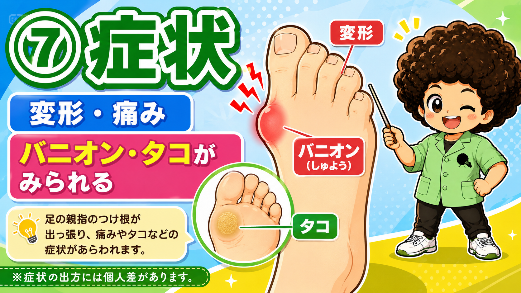 変形・痛みに加え、バニオンやタコがみられる