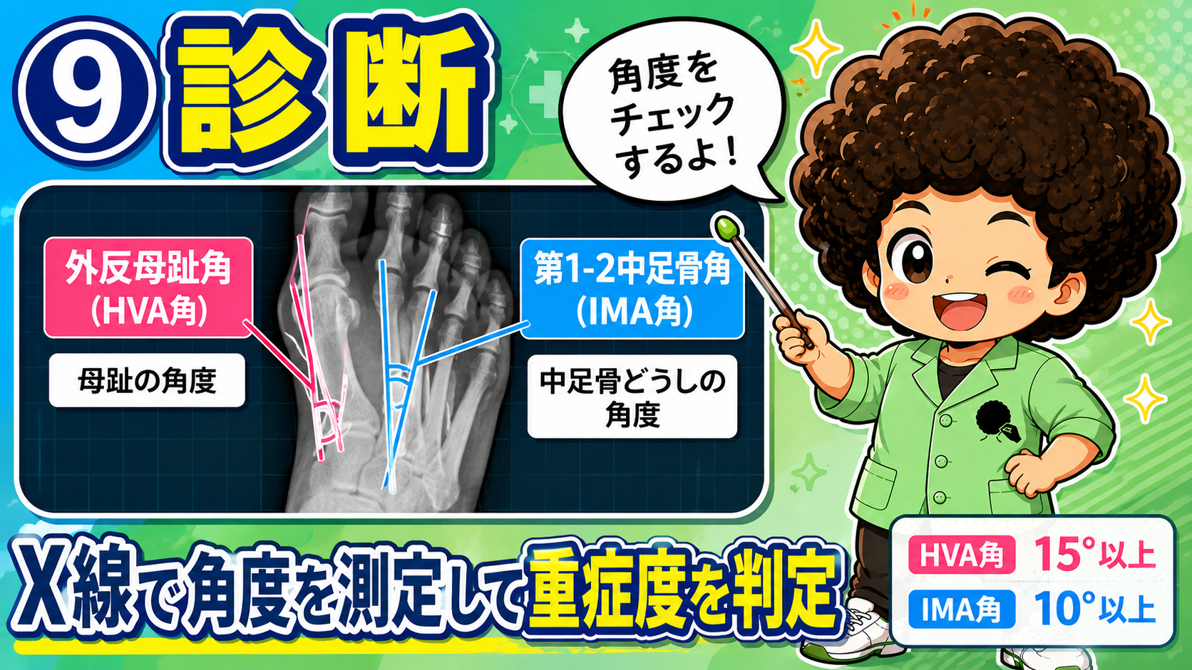 X線でHVA角・IMA角を測定し重症度を判定する