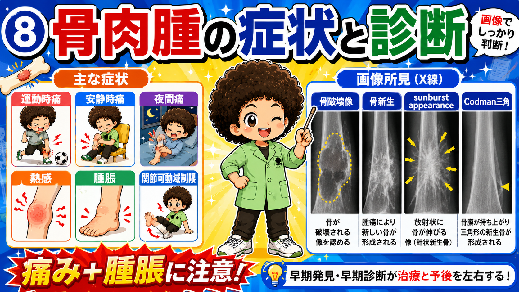 骨肉腫の症状とX線画像所見（sunburst appearance・Codman三角）