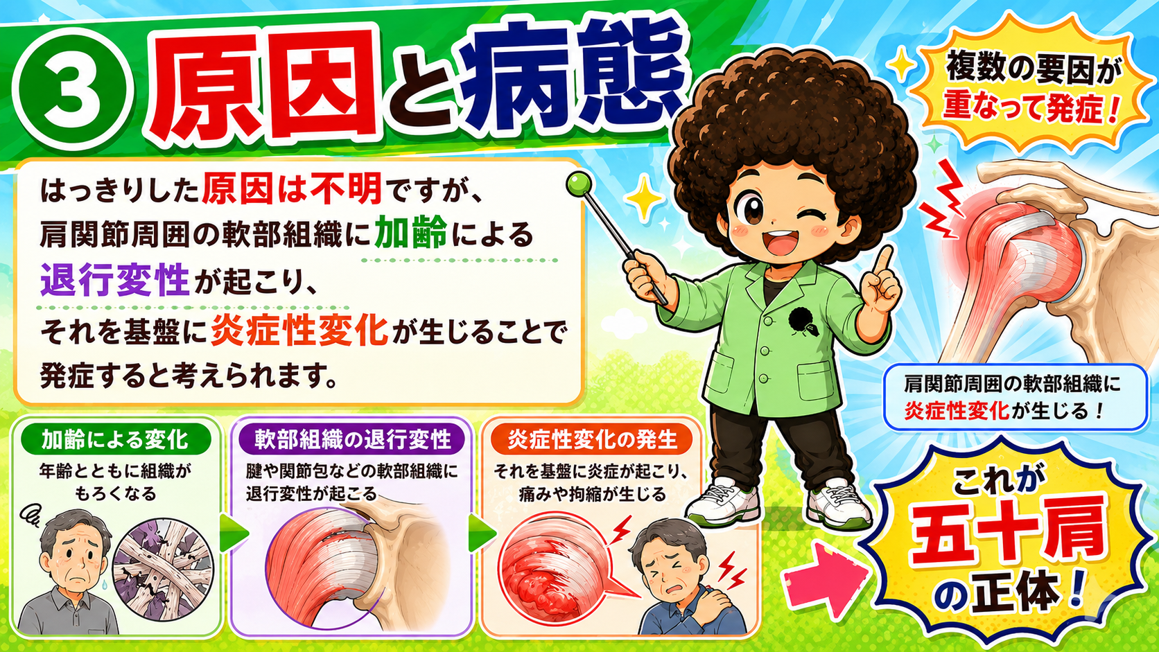 加齢による退行変性を基盤に炎症性変化が生じるのが五十肩の正体
