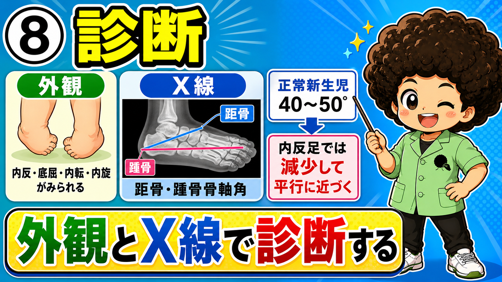 X線での距骨・踵骨骨軸角：正常40〜50°→内反足では減少し平行に近づく