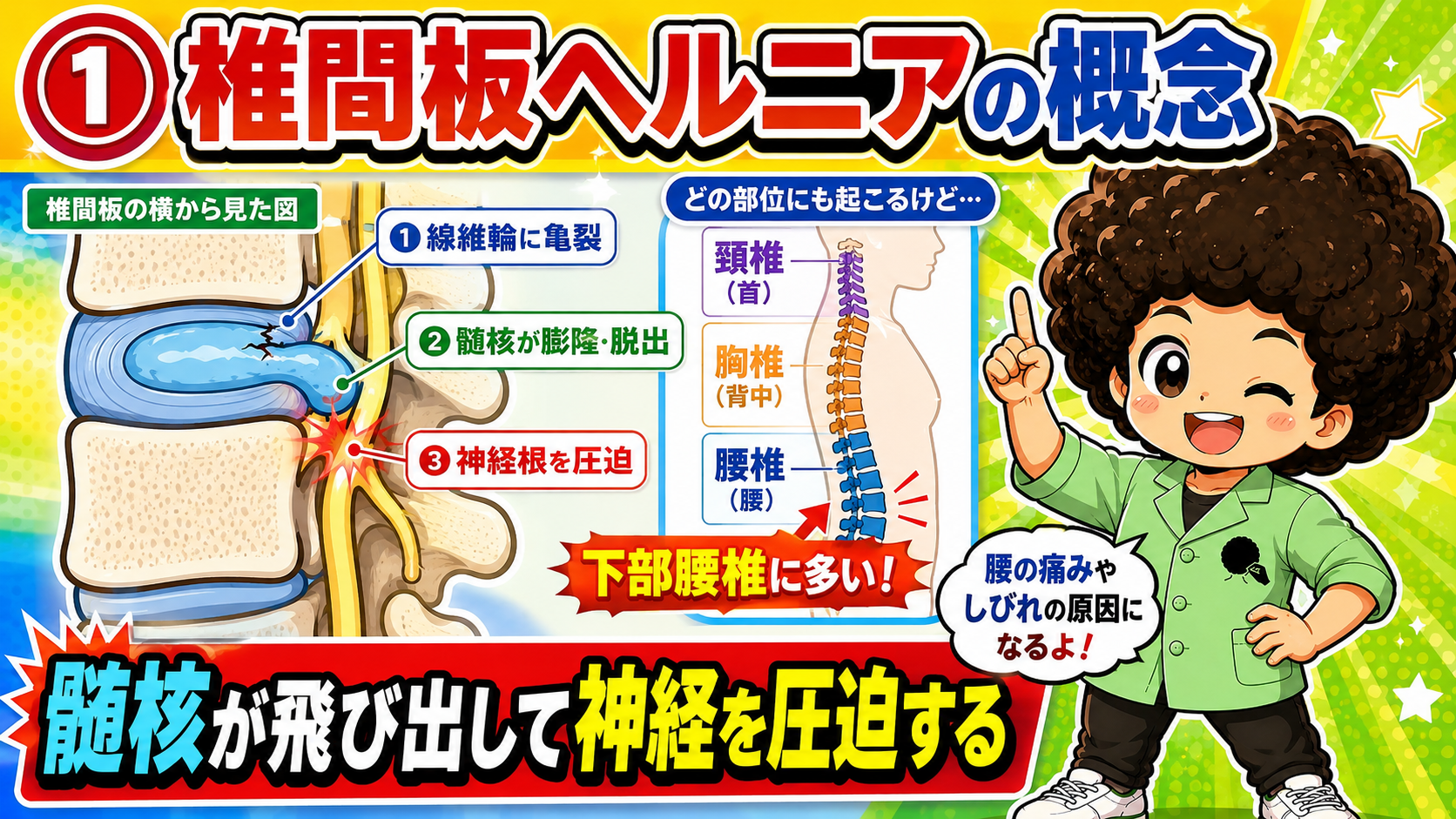 椎間板ヘルニア｜椎間板ヘルニア 1