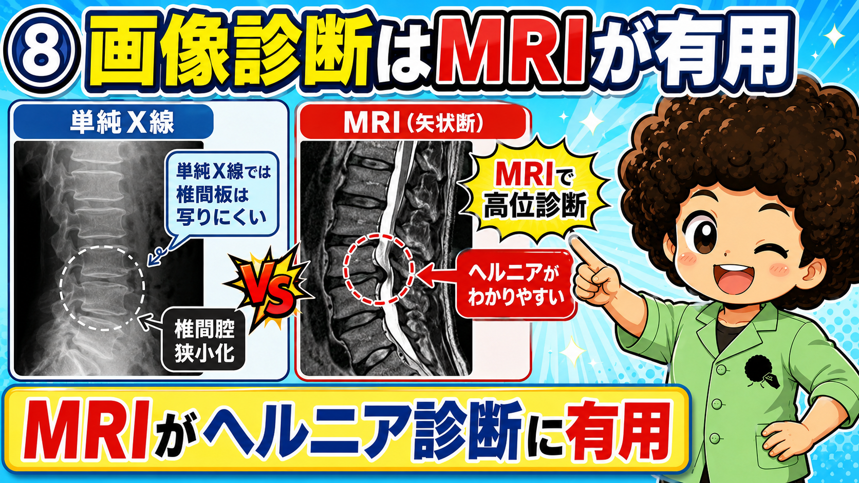 単純X線とMRIの比較。MRIはヘルニアの描出・高位診断に有用