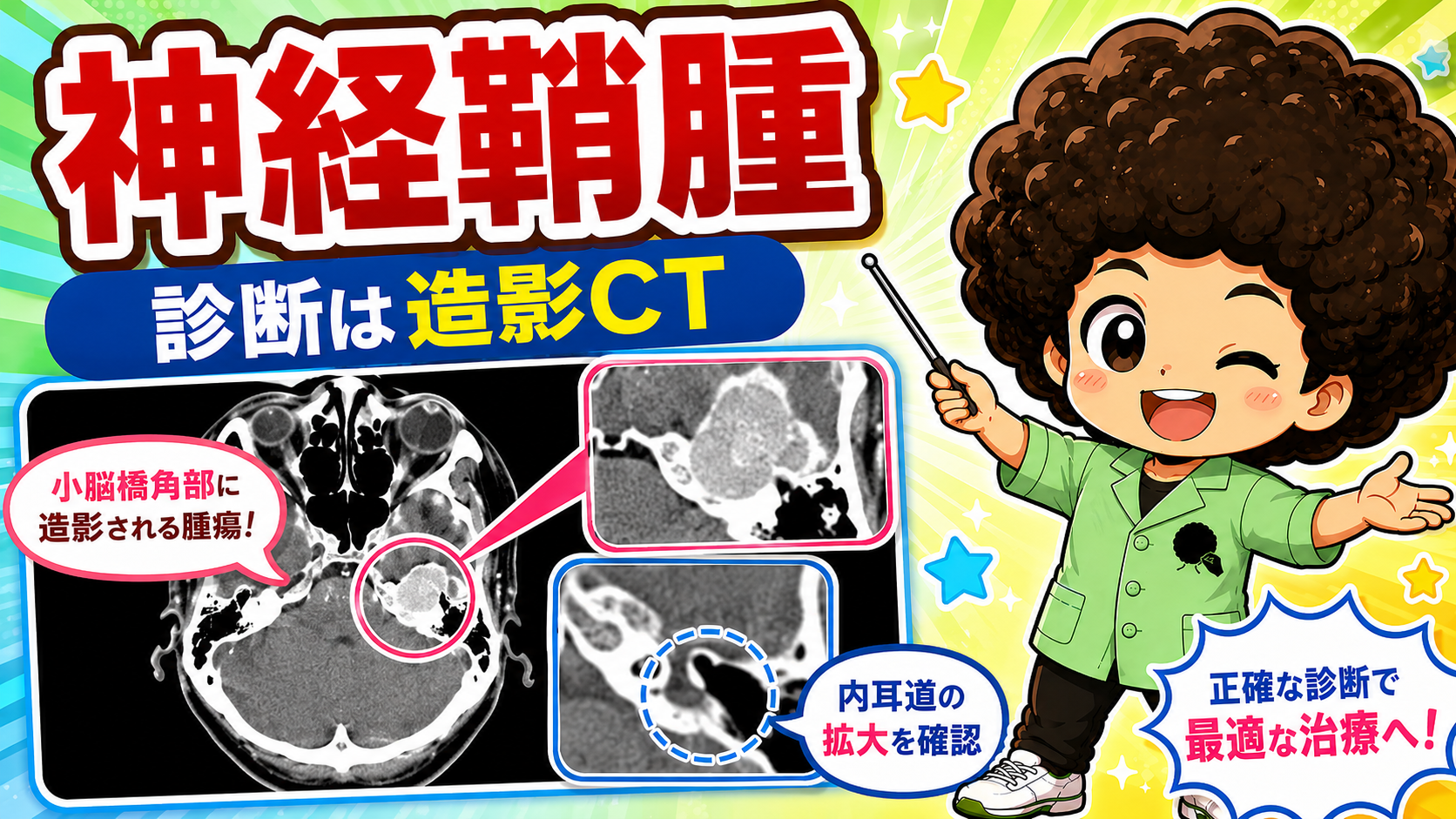 造影CTで小脳橋角部の腫瘍・内耳道の拡大を確認する