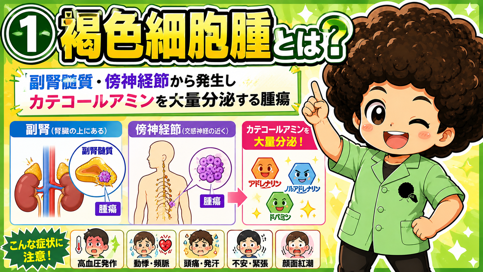 褐色細胞腫｜褐色細胞腫 1