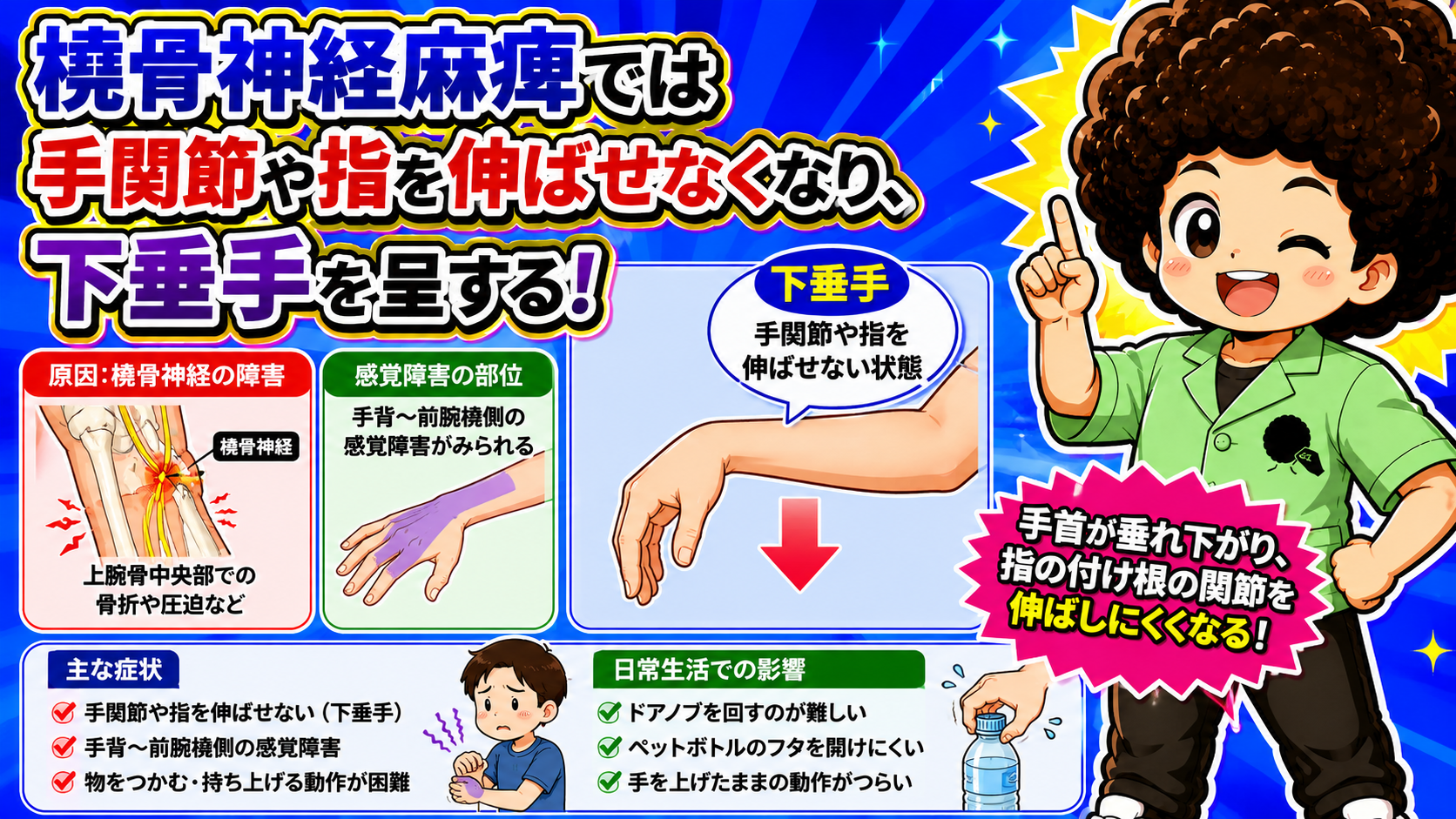 橈骨神経麻痺では手関節や指を伸ばせず下垂手を呈する