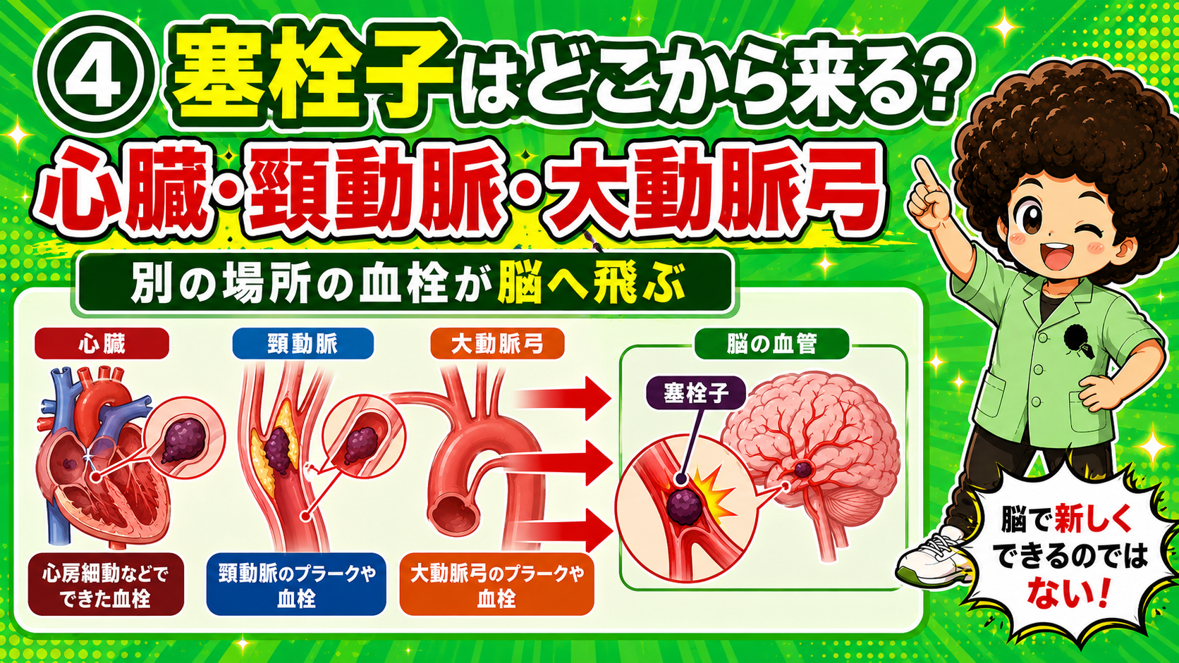 心臓・頸動脈・大動脈弓の血栓が脳へ飛んで詰まる