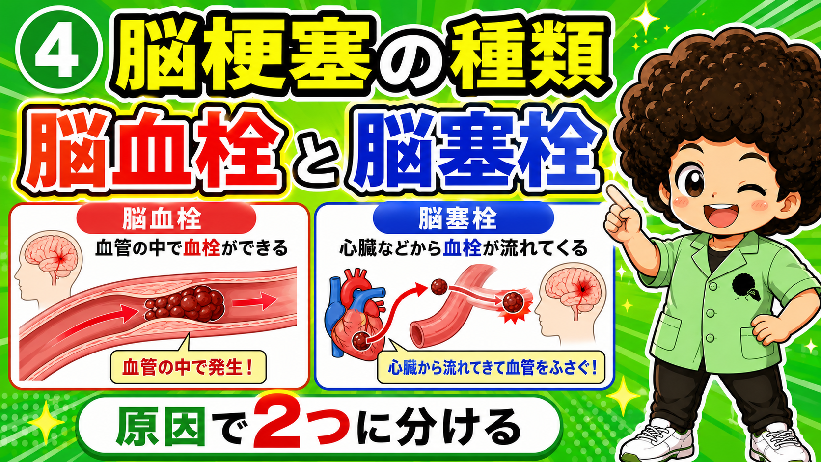 脳梗塞は原因により脳血栓と脳塞栓に分けられる