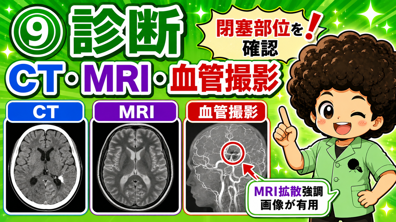 診断はCT・MRI・血管撮影で閉塞部位を確認する