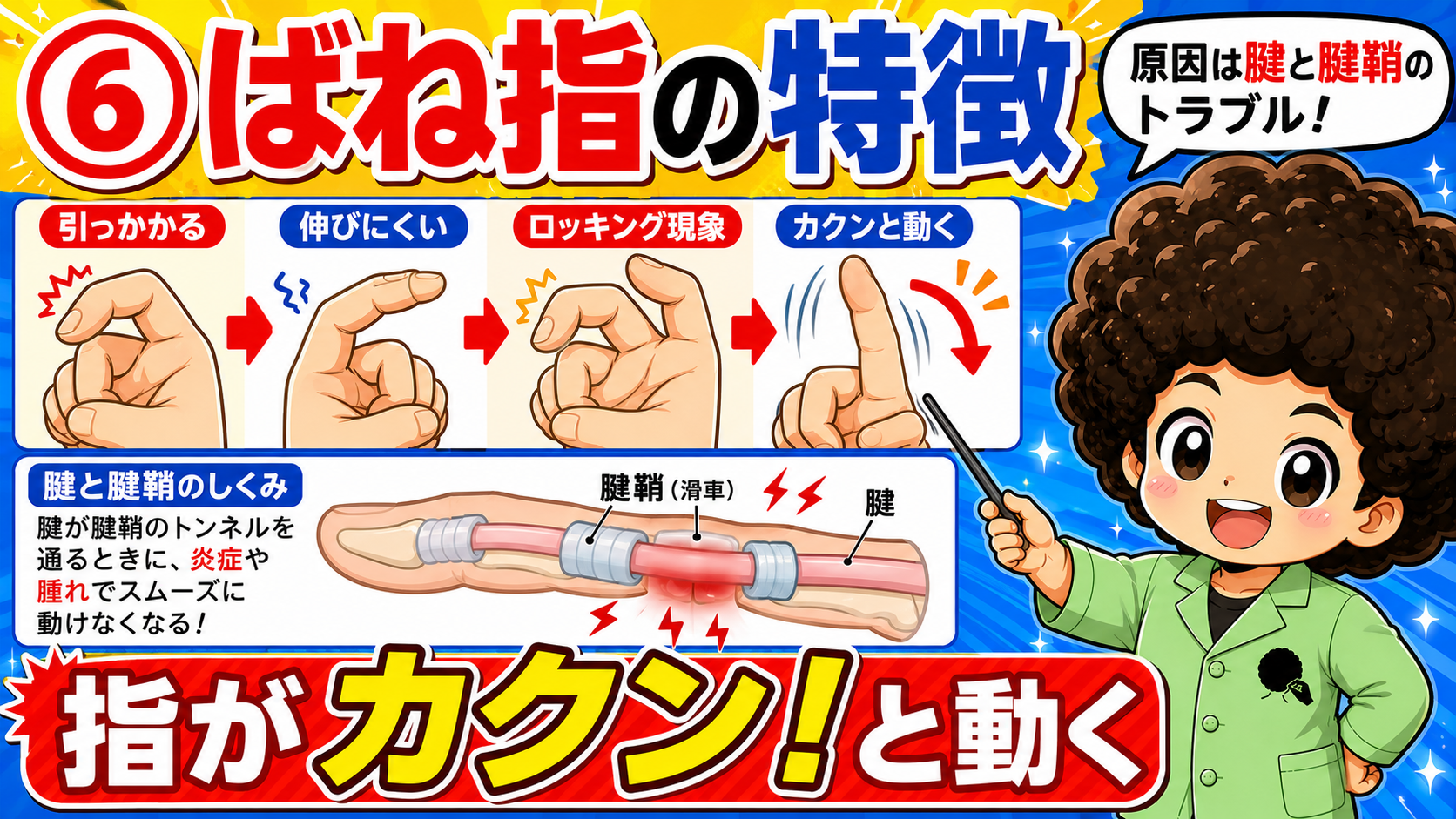 腱が腱鞘のトンネルで引っかかり、指がカクンと動くばね指のしくみ
