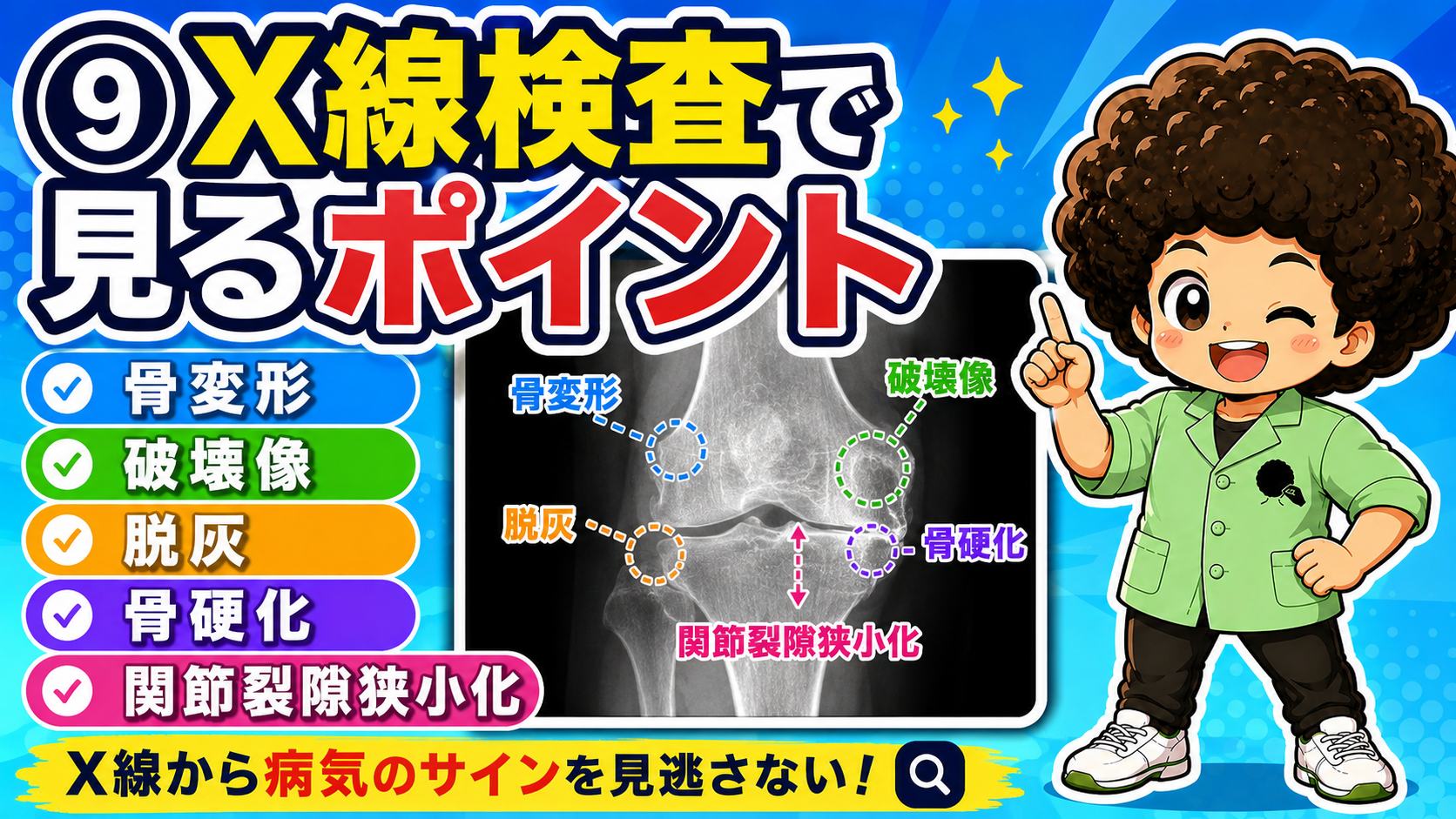 X線では骨変形・破壊像・脱灰・骨硬化・関節裂隙狭小化を確認する