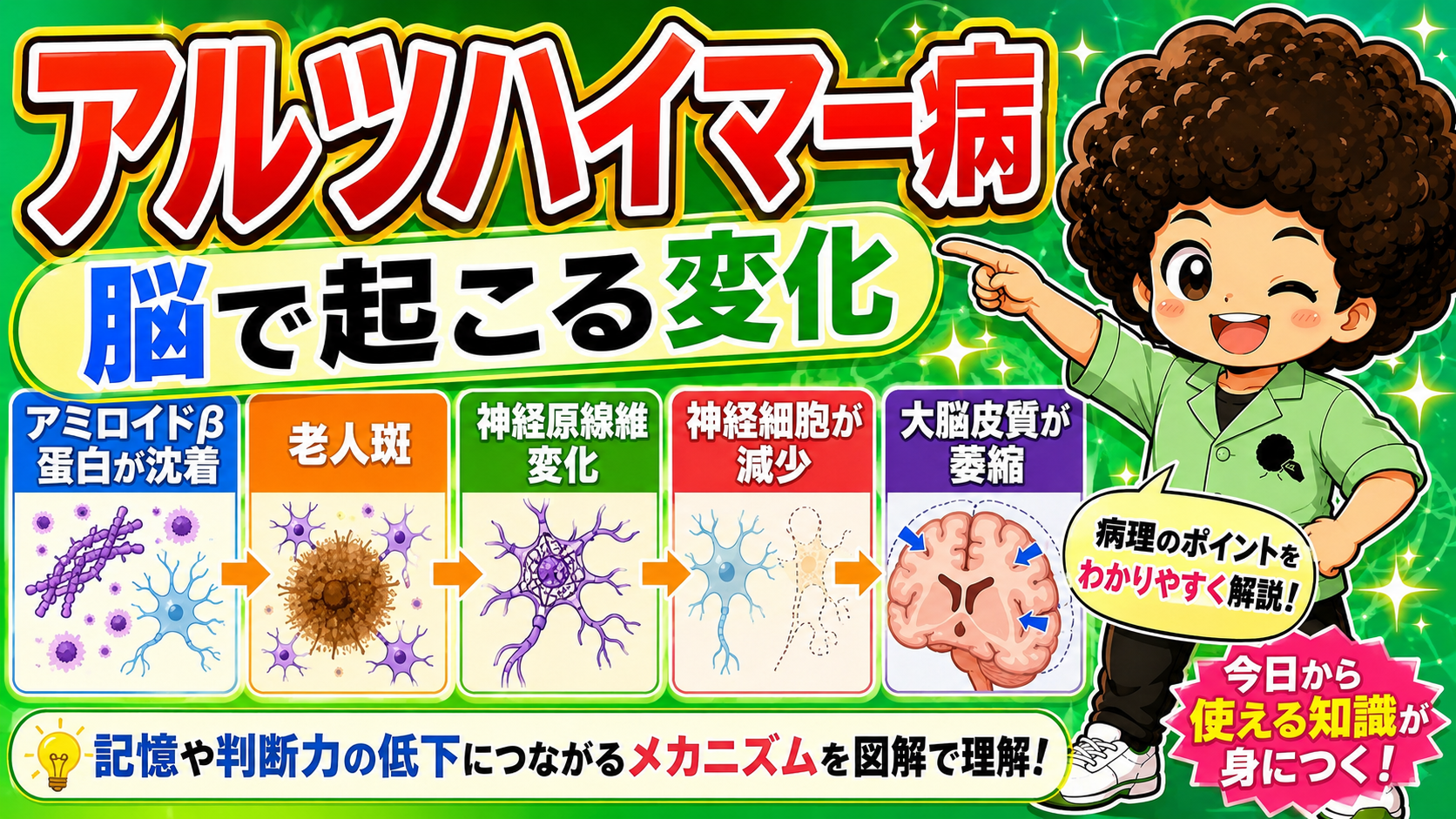 アミロイドβ沈着→老人斑→神経原線維変化→神経細胞減少→大脳皮質萎縮