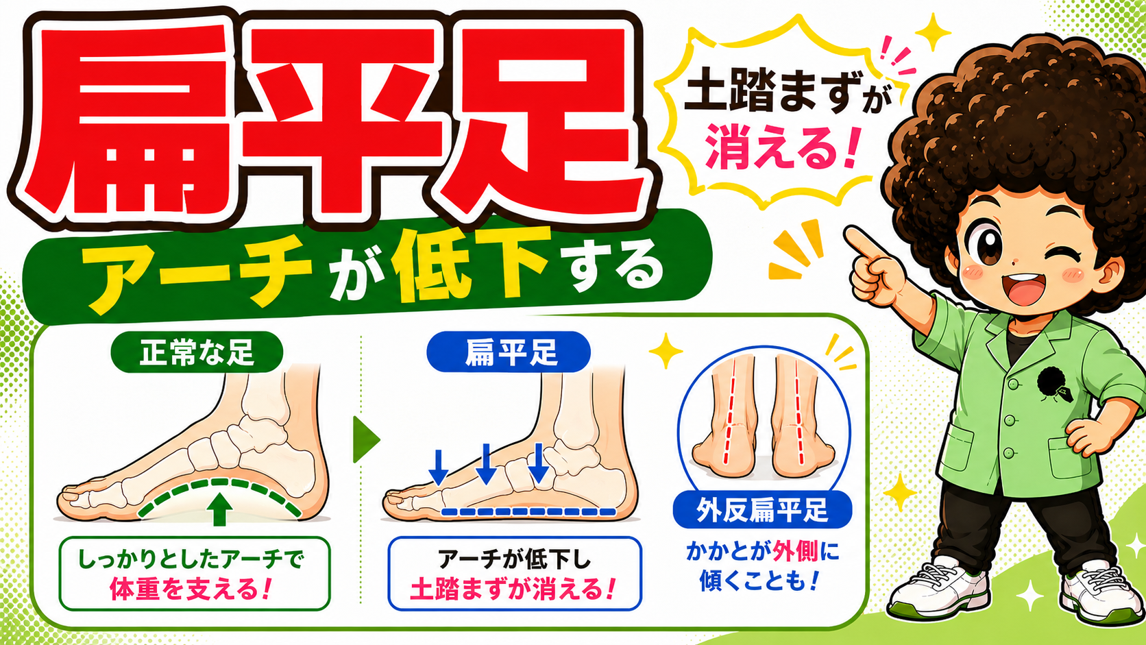 扁平足＝アーチが低下し土踏まずが消える（外反扁平足の踵外反にも注意）