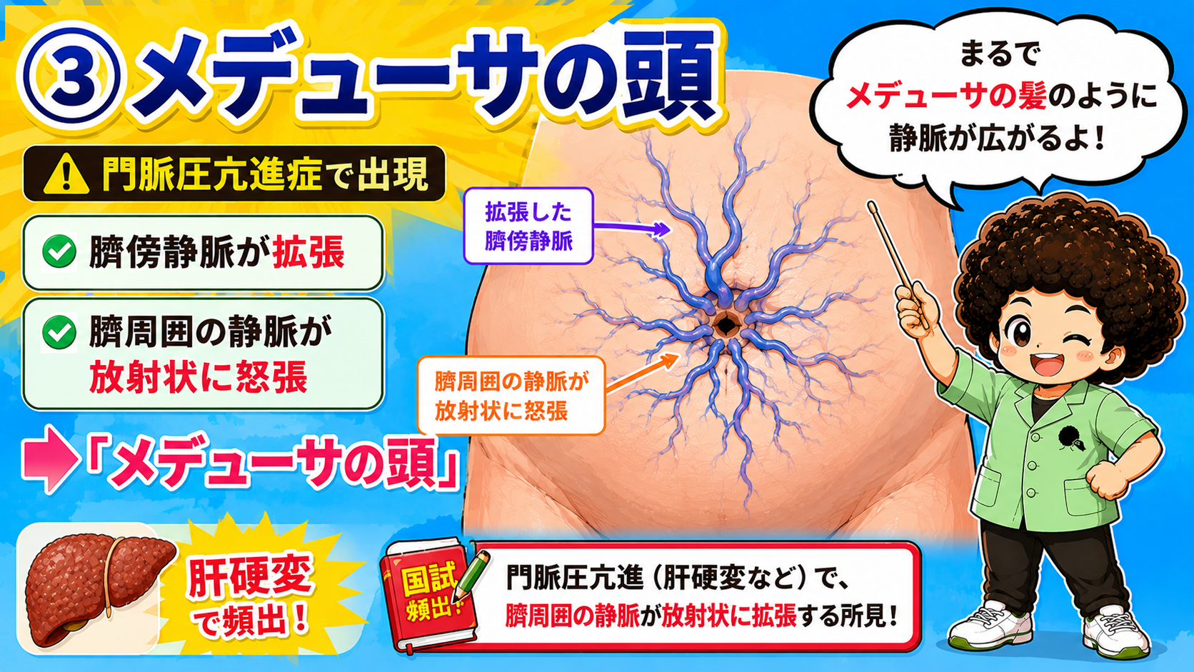 メデューサの頭（臍傍静脈の拡張・臍周囲静脈の放射状怒張）